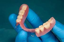 Partial denture