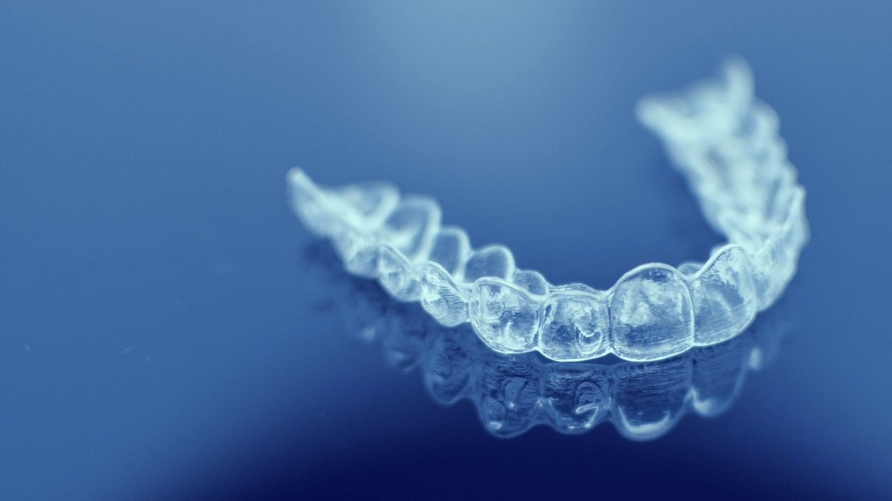 In-house clear aligner